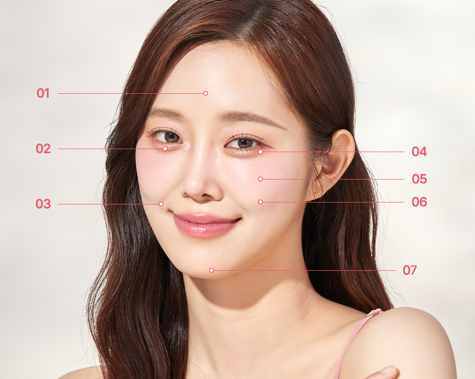 지방이식