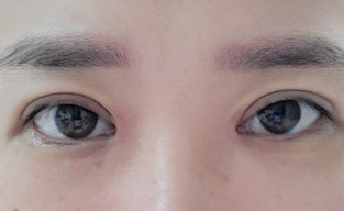 쌍수후기