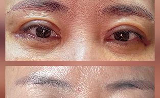 탁월한 선택